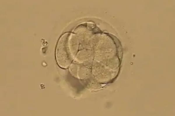 成功试管从了解胚胎养囊开始！