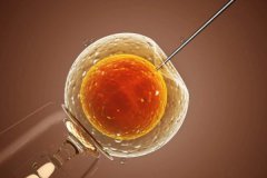 成都做试管婴儿卵泡多大适合取卵？取卵后卵巢增大怎么办？