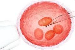 取卵后积液多少正常？取卵后如何保养卵巢？