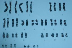 检查染色体需要空腹吗？囊胚染色体筛选要多久？
